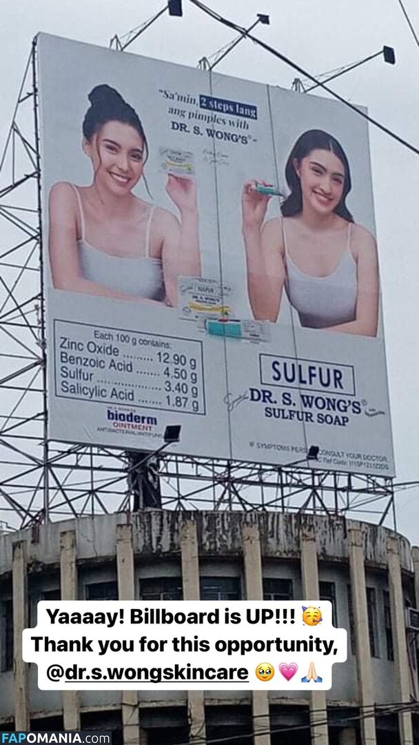 Analyn Barro Γυμνός OnlyFans  Διαρρεύσαστη φωτογραφία #10