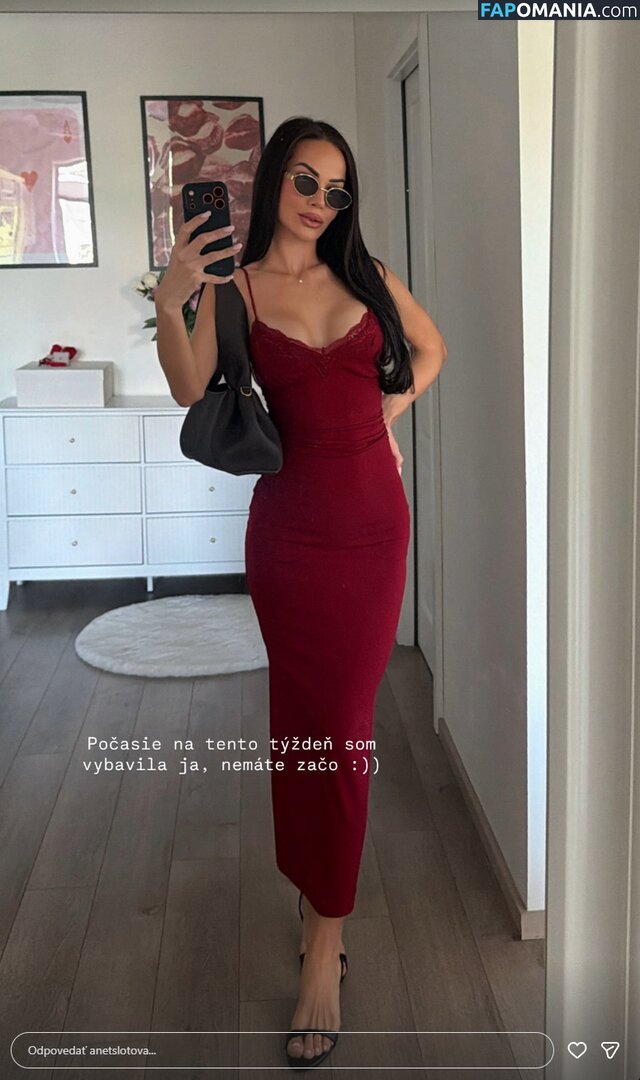 Anet Slotova / anetslotova Γυμνός OnlyFans  Διαρρεύσαστη φωτογραφία #1